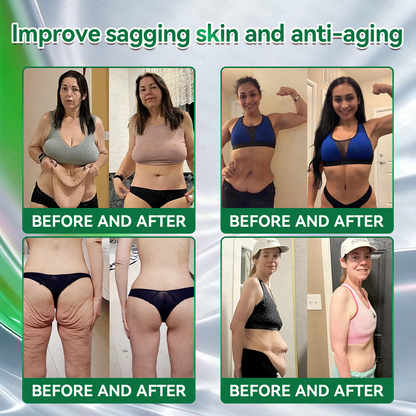 𝑶𝒇𝒇𝒊𝒄𝒊𝒂𝒍 𝑺𝒕𝒐𝒓𝒆 | 𝐉𝑶𝗔𝙀®🌈𝐆𝑳𝗣-1 𝟐𝟎-𝐢𝐧-𝟏 𝐒𝐥𝐢𝐦 & 𝐇𝐞𝐚𝐥𝐭𝐡 𝐎𝐫𝐚𝐥 𝐒𝐨𝐥𝐮𝐭𝐢𝐨𝐧 -𝑶𝒏𝒄𝒆 𝒂 𝒅𝒂𝒚, 𝒓𝒆𝒔𝒖𝒍𝒕𝒔 𝒊𝒏 6 𝒅𝒂𝒚𝒔, 𝑾𝒊𝒕𝒉 100 𝑩𝒊𝒍𝒍𝒊𝒐𝒏 𝑪𝑭𝑼 𝑨𝒄𝒕𝒊𝒗𝒆 𝑷𝒓𝒐𝒃𝒊𝒐𝒕𝒊𝒄𝒔 ✅ 𝑺𝒖𝒑𝒑𝒐𝒓𝒕𝒔 𝒘𝒆𝒊𝒈𝒉𝒕 𝒎𝒂𝒏𝒂𝒈𝒆𝒎𝒆𝒏𝒕, 𝒉𝒆𝒂𝒓𝒕 𝒉𝒆𝒂𝒍𝒕𝒉, 𝒅𝒊𝒂𝒃𝒆𝒕𝒆𝒔, 𝒈𝒖𝒕 & 𝒘𝒐𝒎𝒆𝒏’𝒔 𝒉𝒆𝒂𝒍𝒕𝒉, 𝒘𝒉𝒊𝒍𝒆 𝒇𝒊𝒓𝒎𝒊𝒏𝒈 𝒔𝒌𝒊𝒏